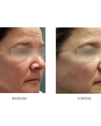 Vivier Redness Solution Complex